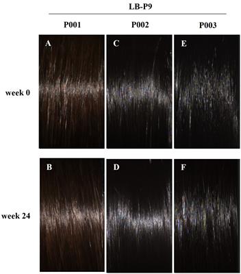 Efficacy and safety of Latilactobacillus curvatus LB-P9 on hair health: a randomized, double-blind, placebo-controlled clinical trial